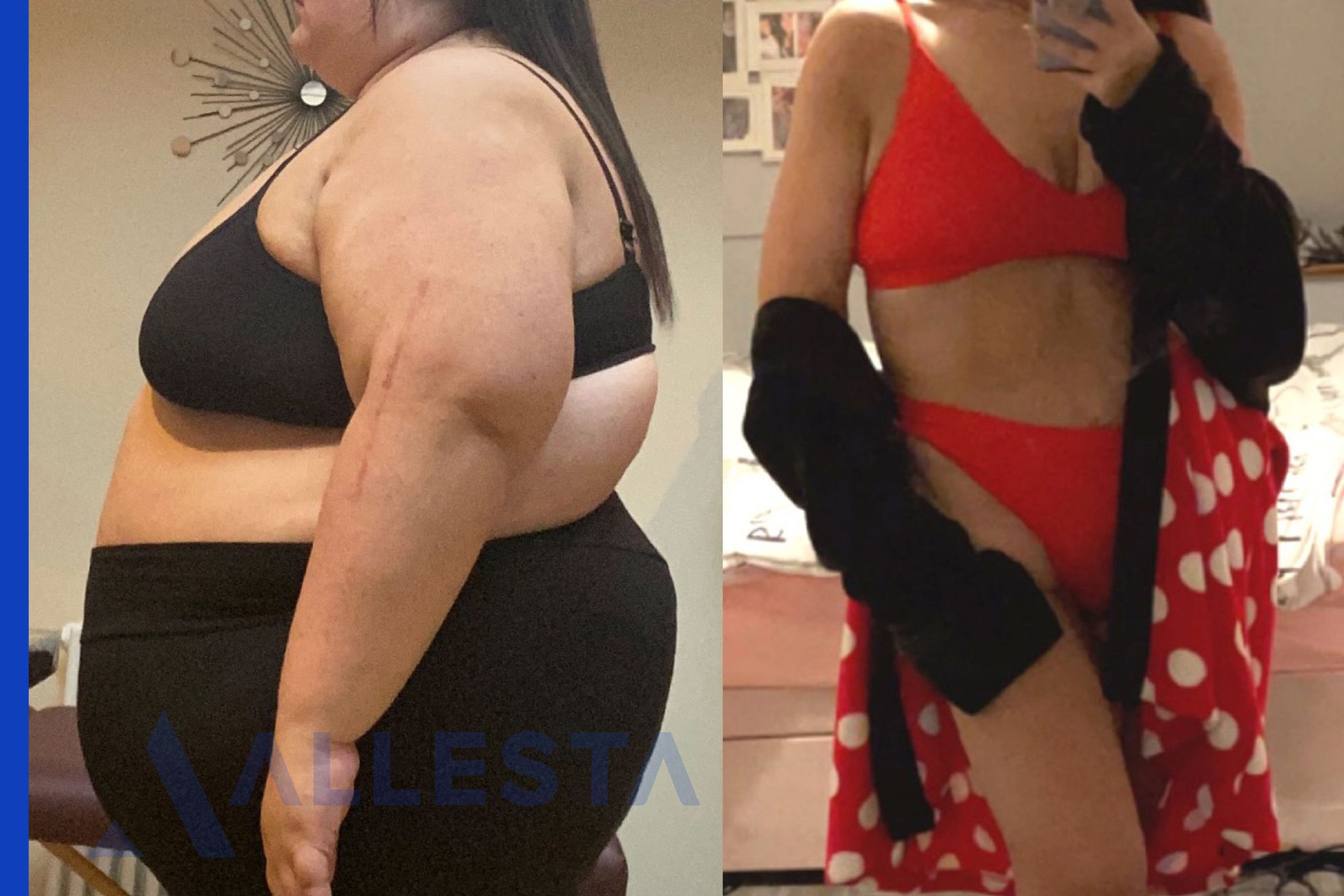 Before and after 5-01