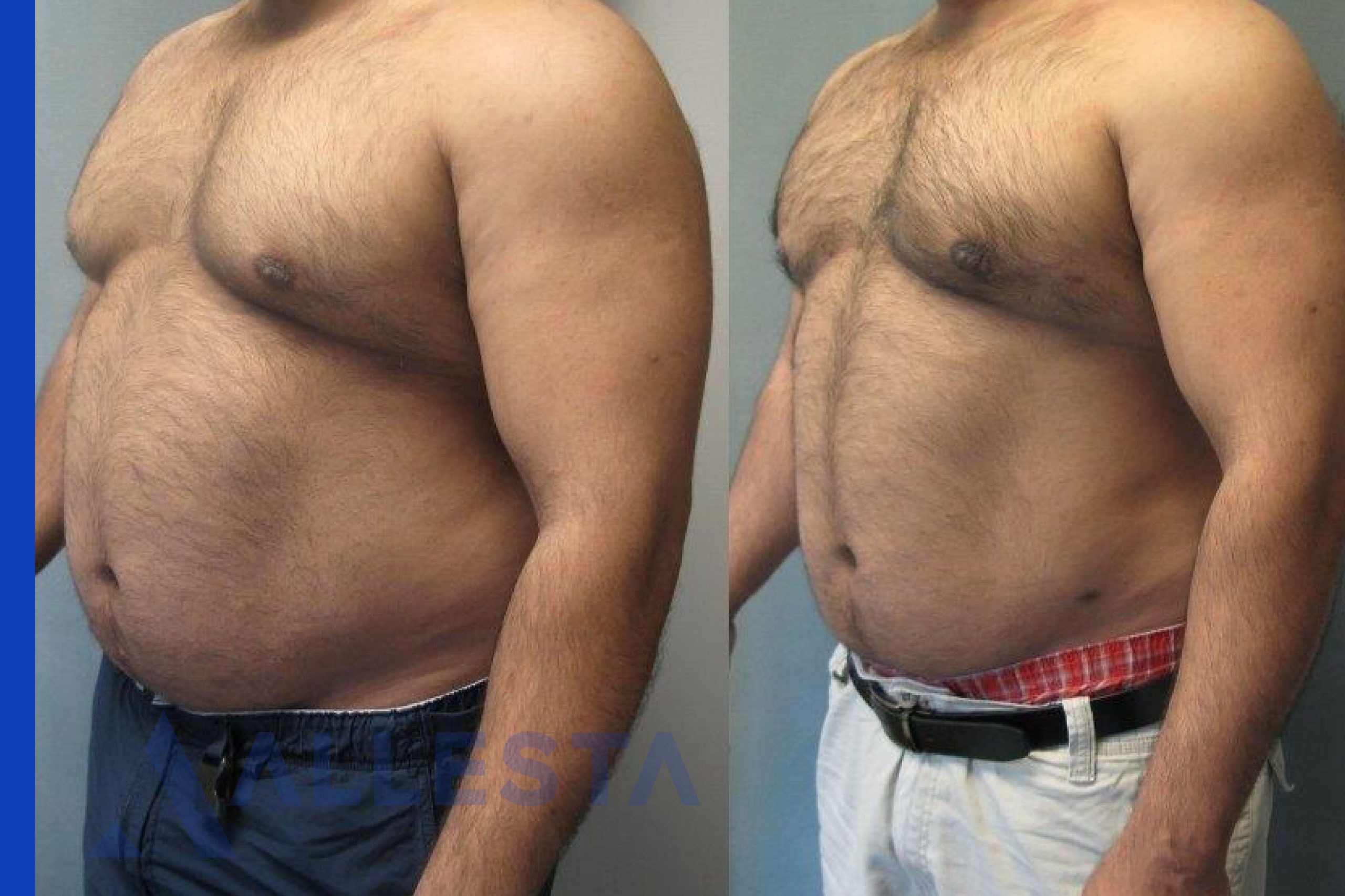 Before and after1-01