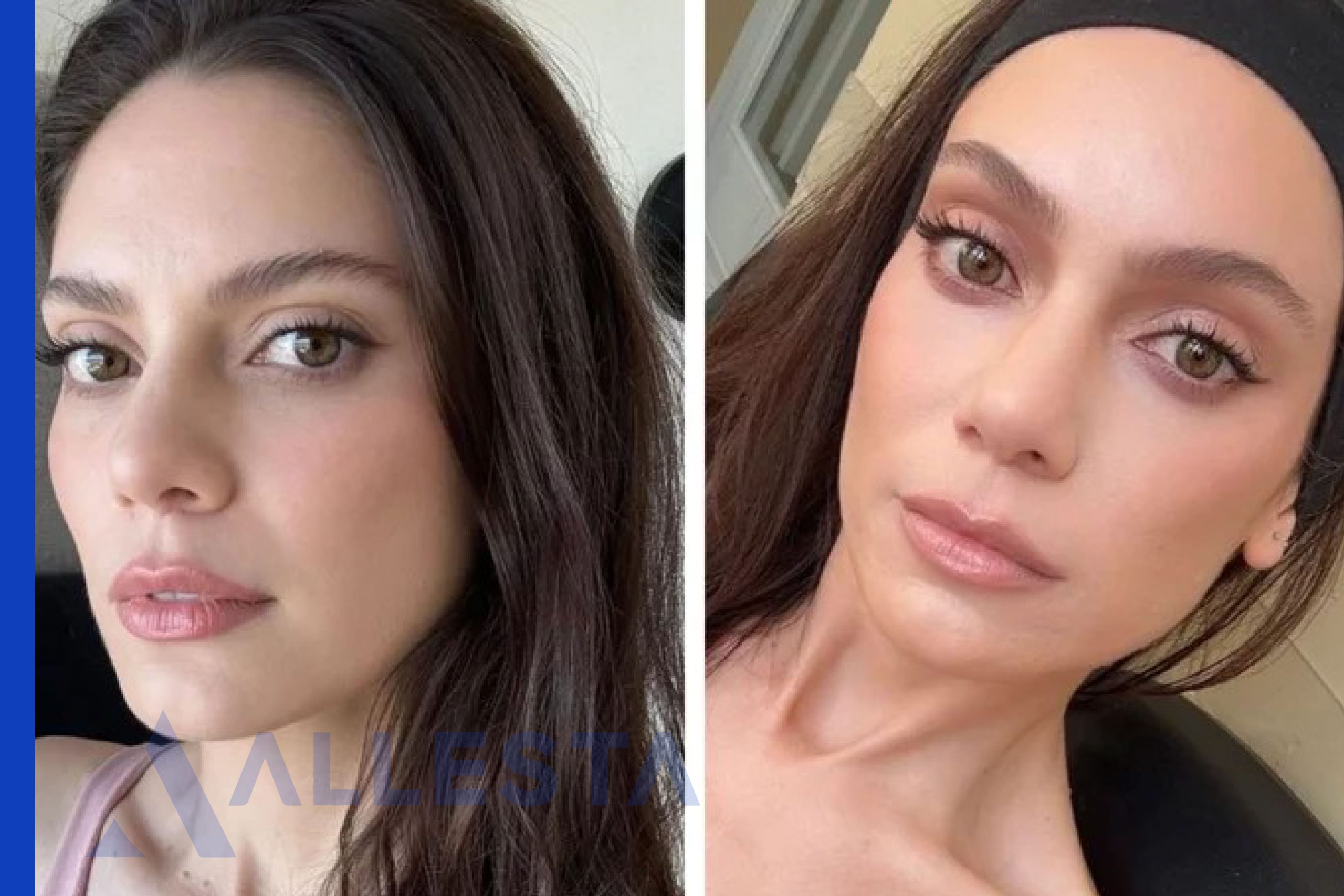 Before and after1-01