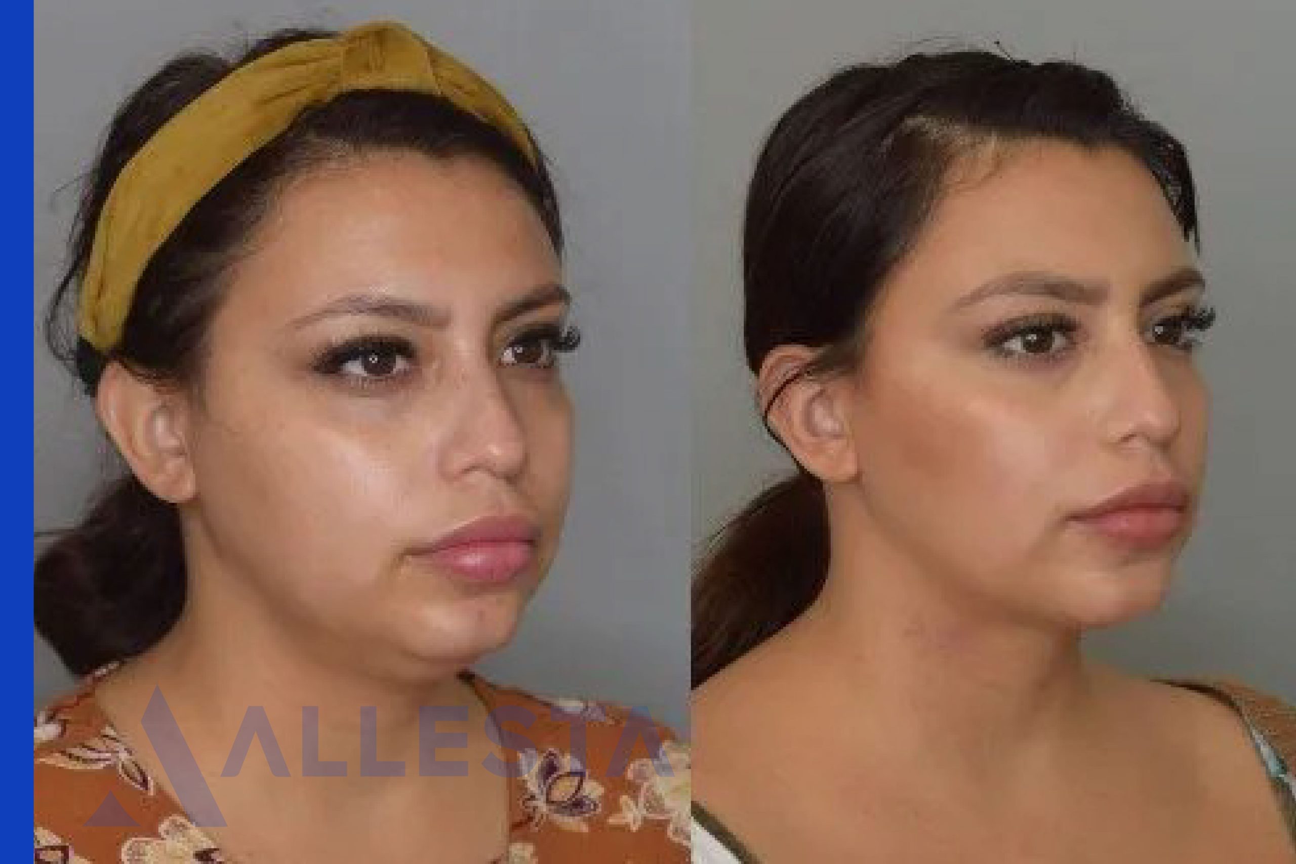 Before and after1-01