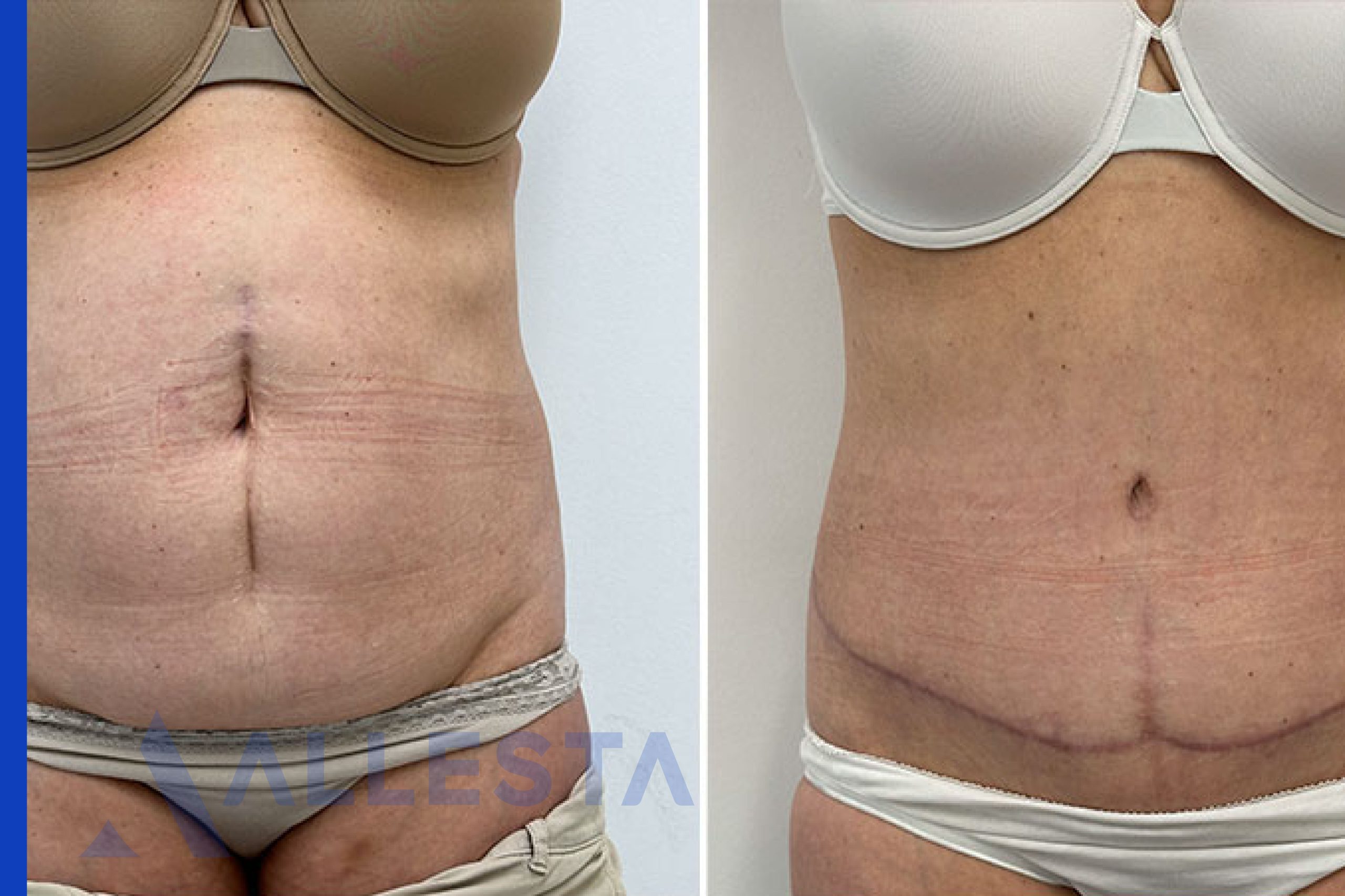 Before and after1-01