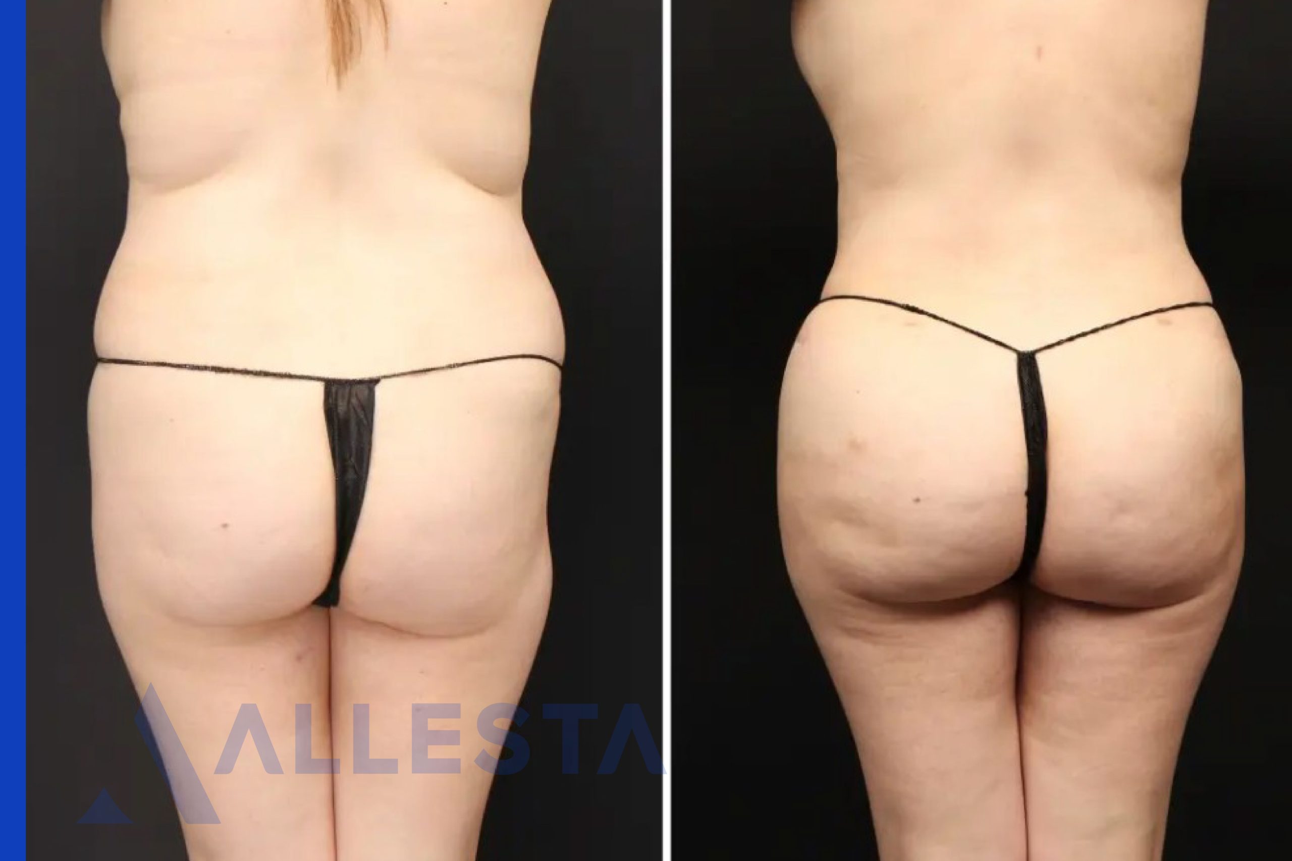 Before and after1-01