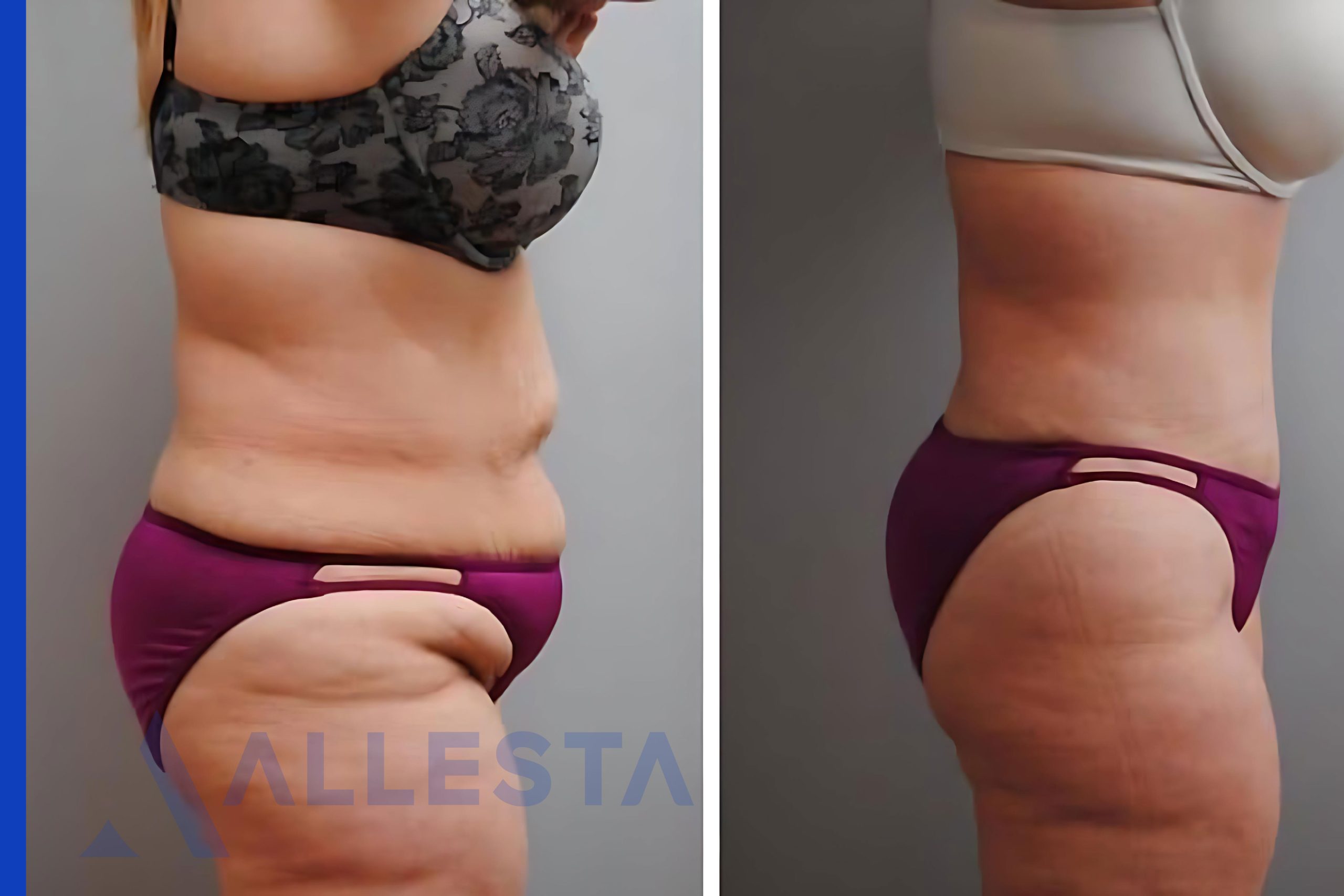 Before and after1-01