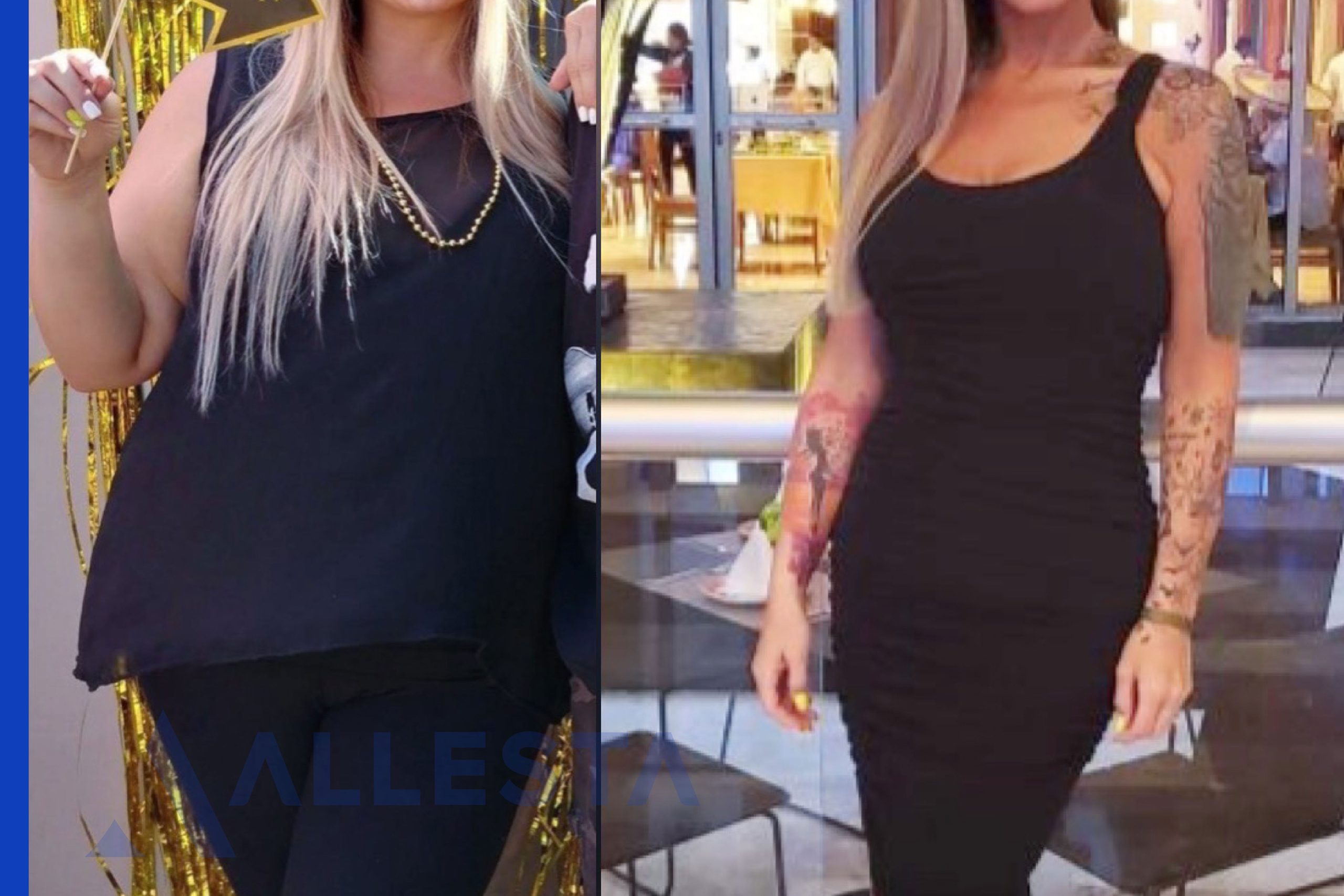 Before and after1-01