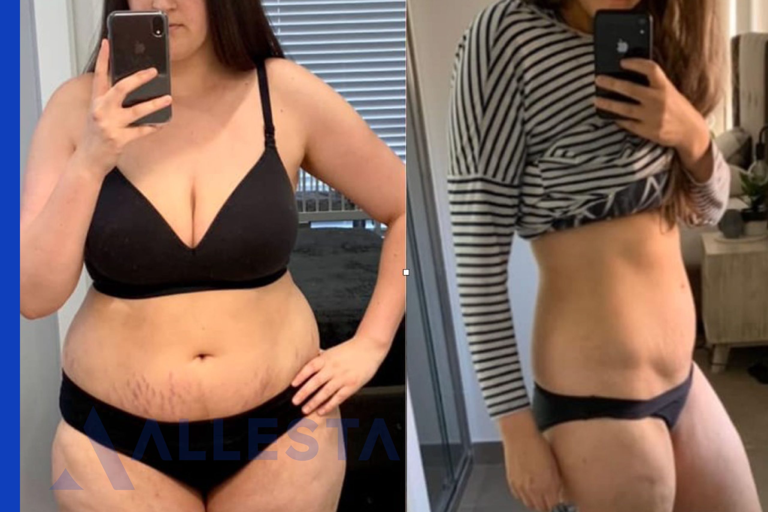 Before and after1-01