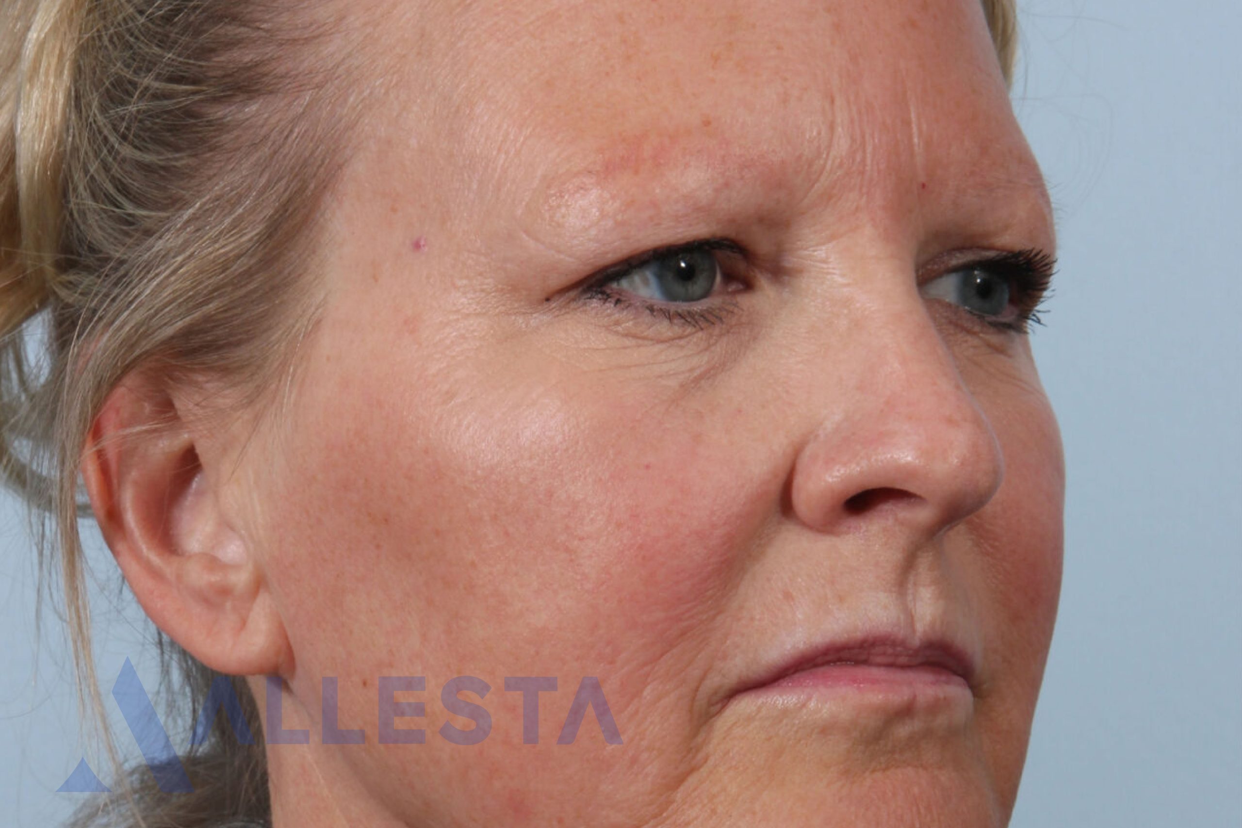 Before and after1-01