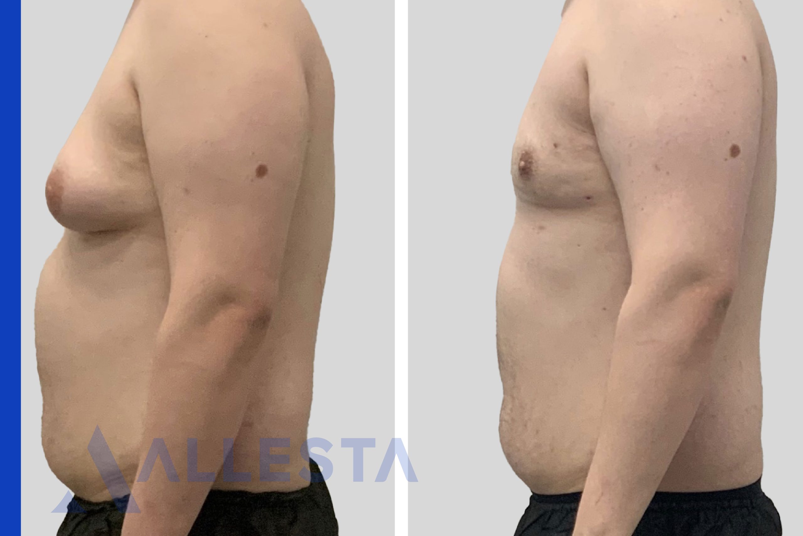 Before and after2-01