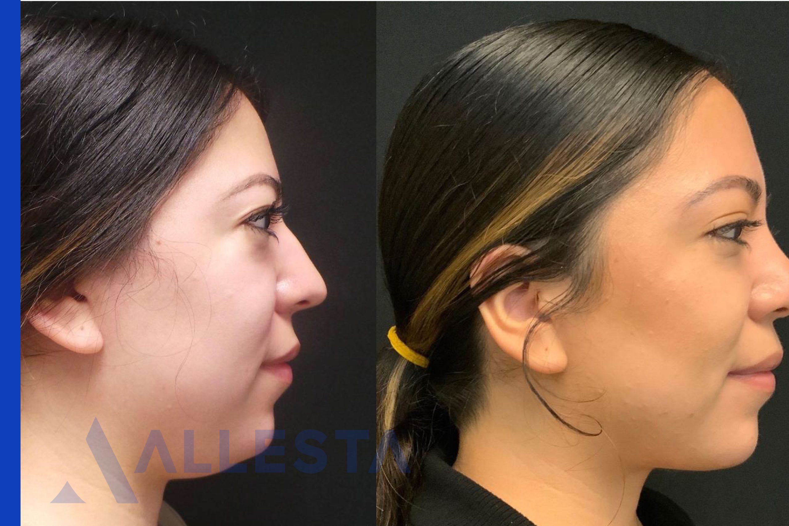 Before and after2-01