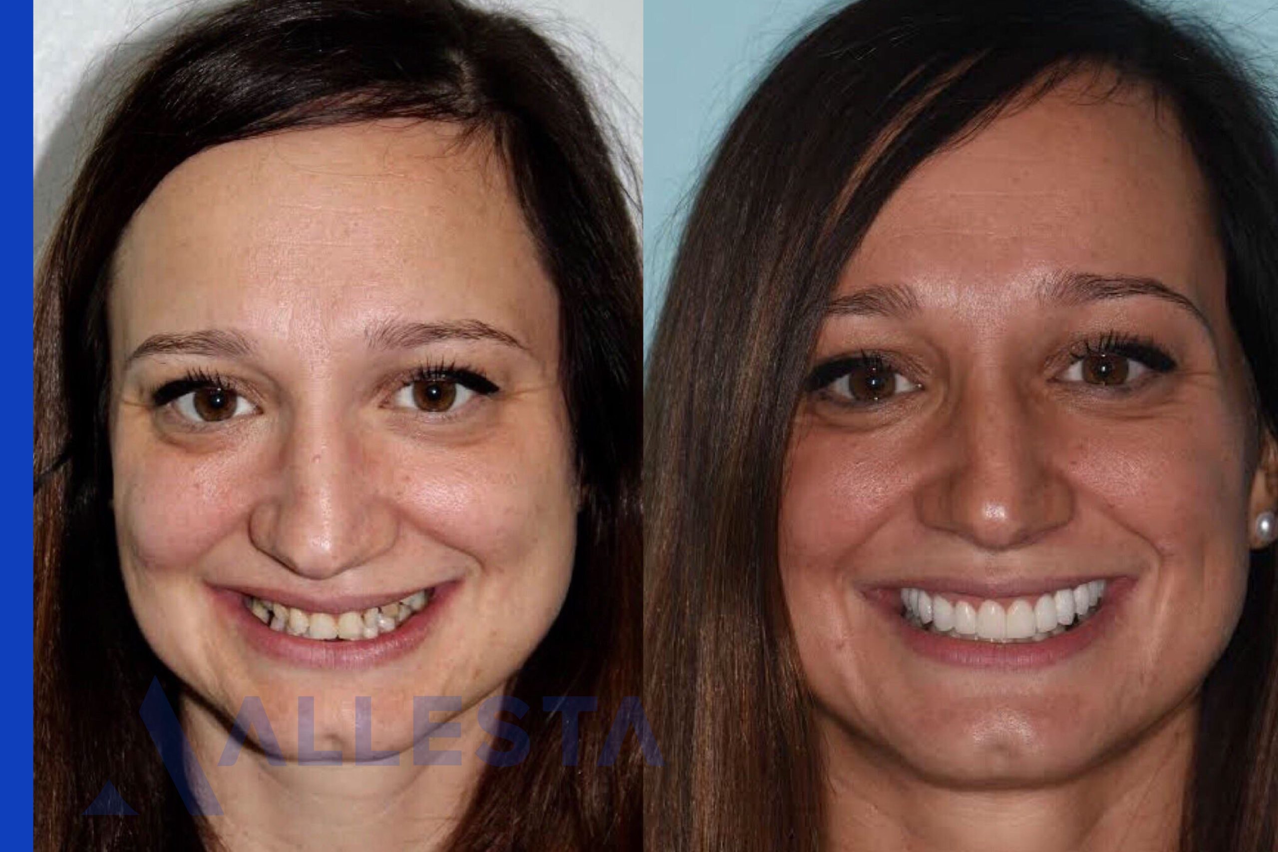 Before and after2-01