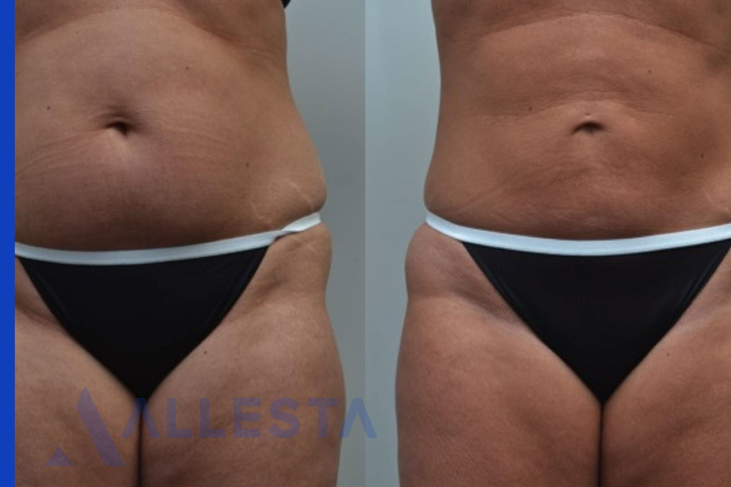 Before and after2-01