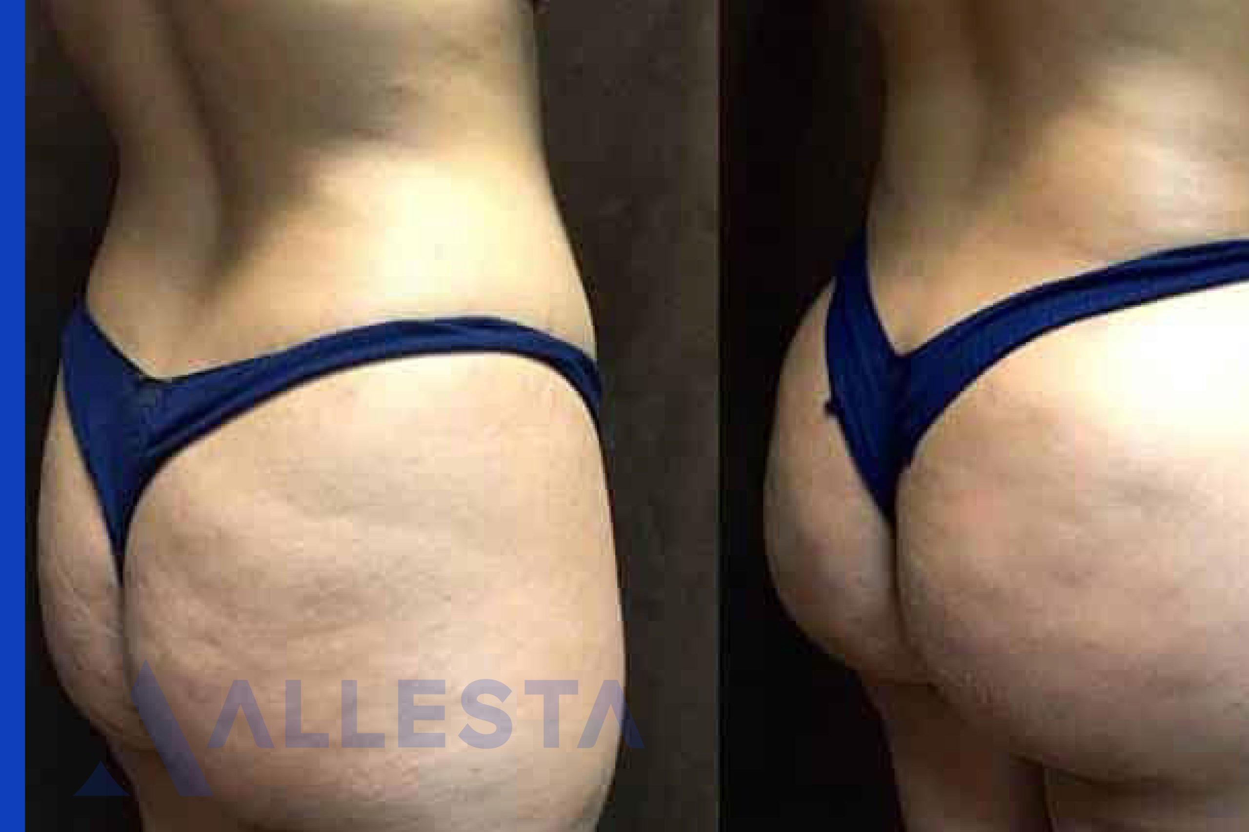 Before and after2-01