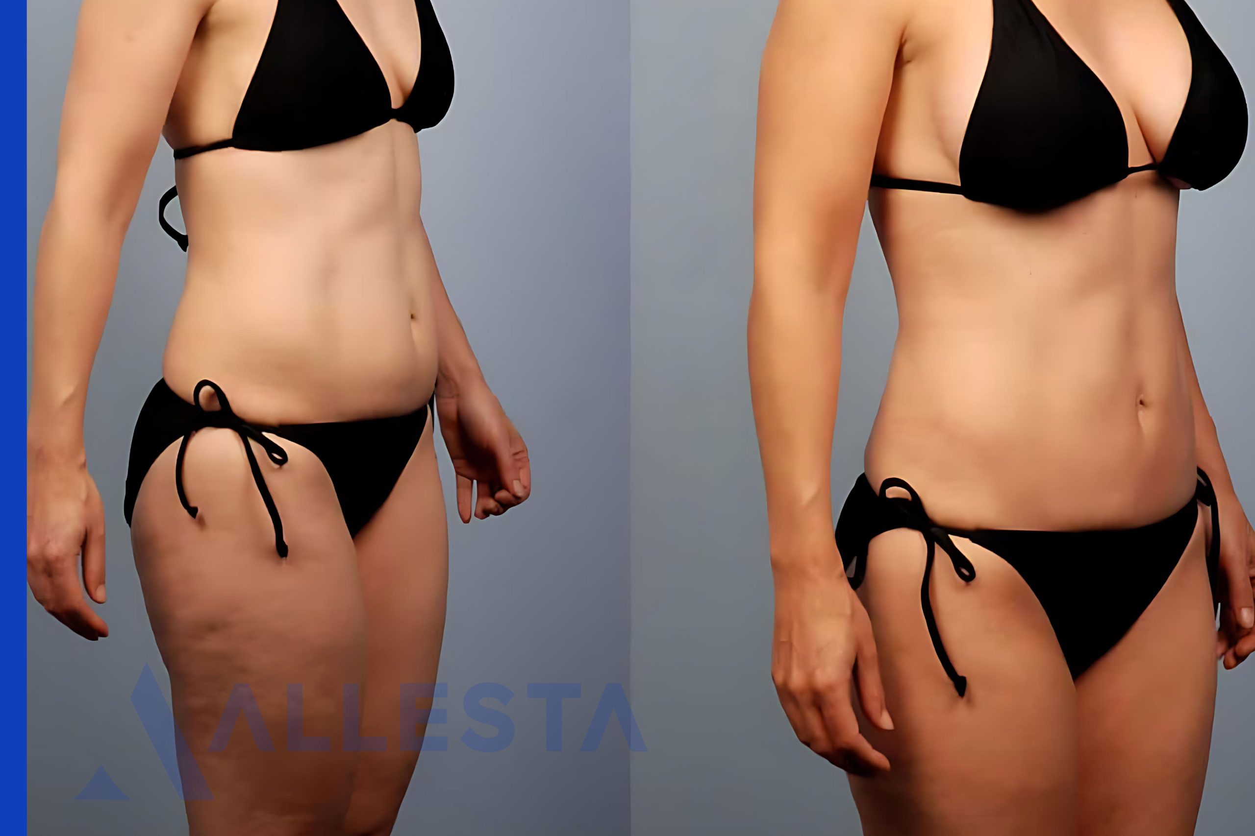 Before and after2-01