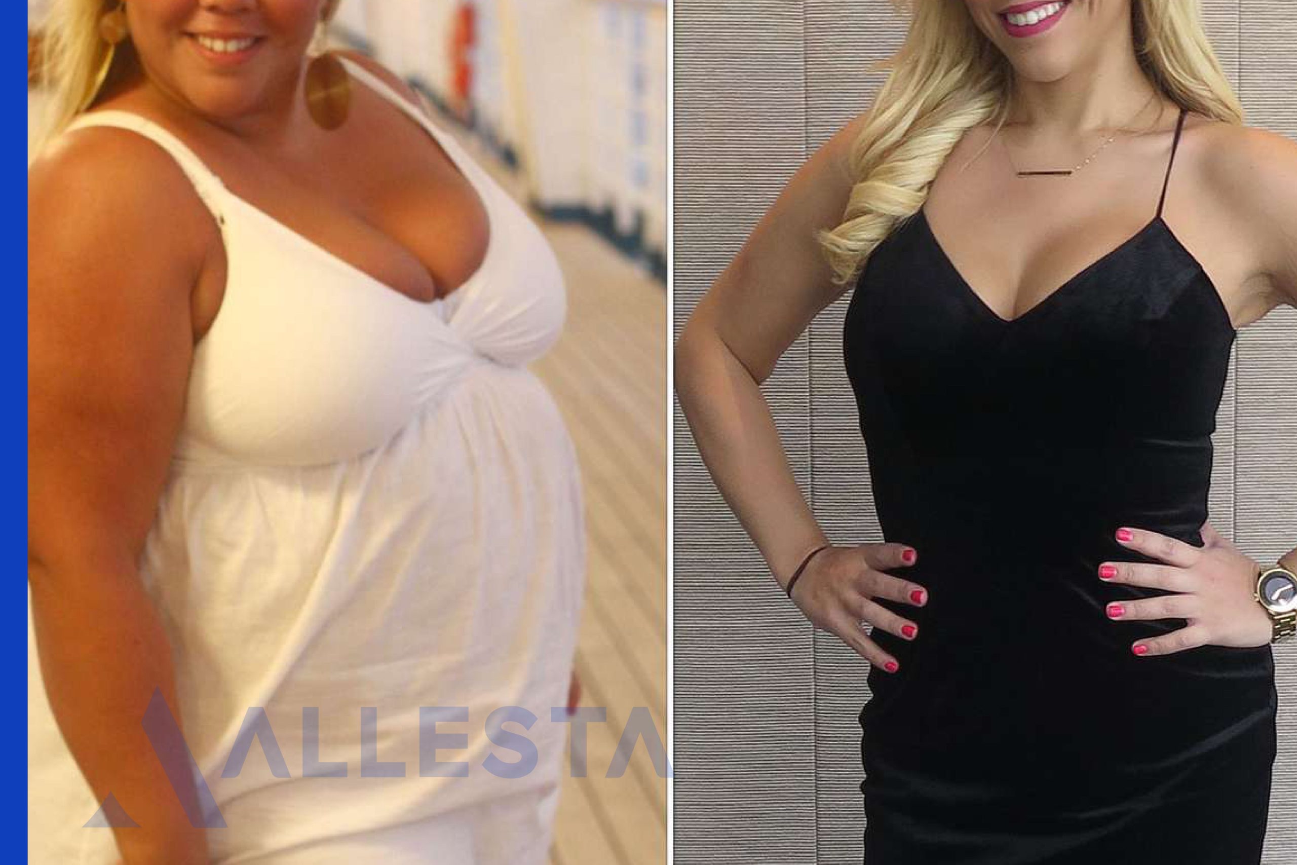 Before and after2-01