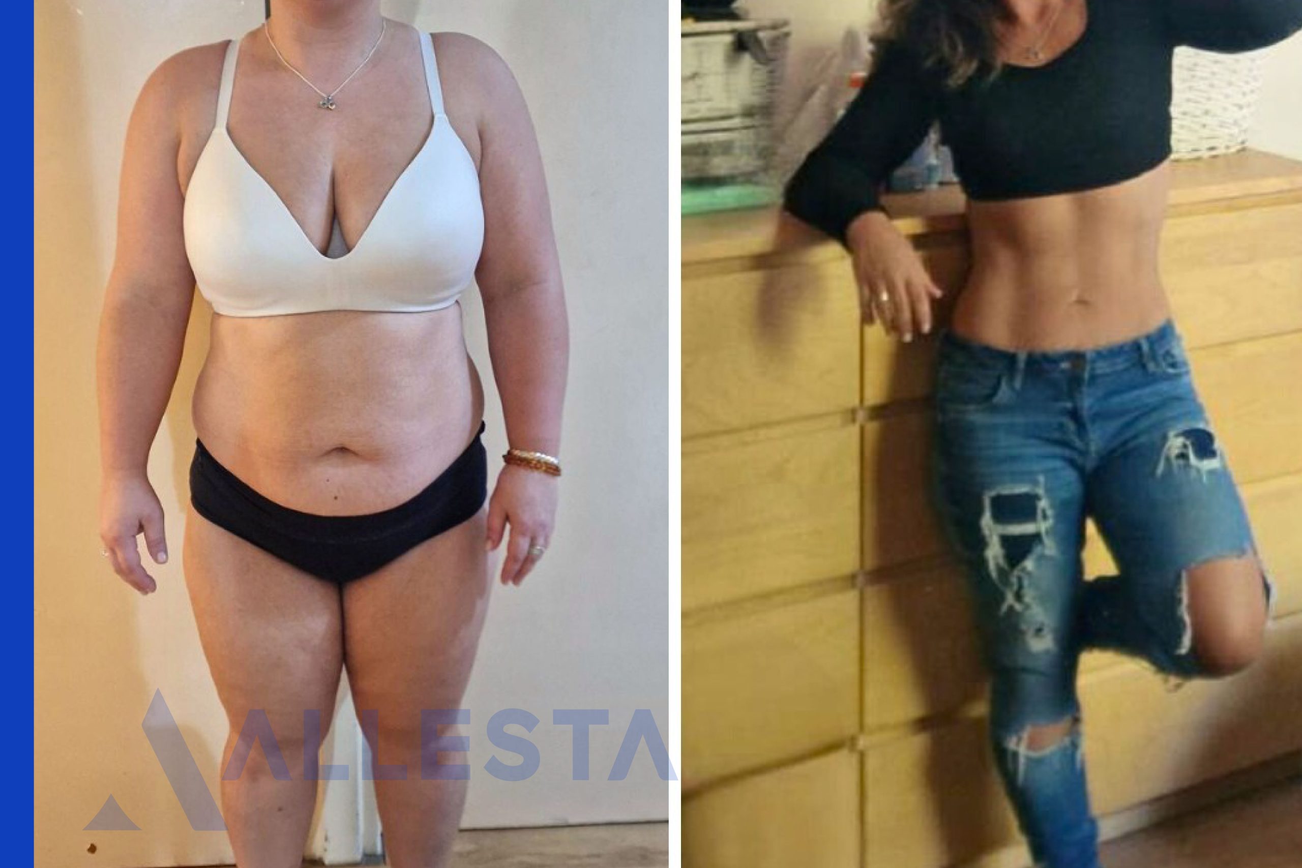 Before and after2-01