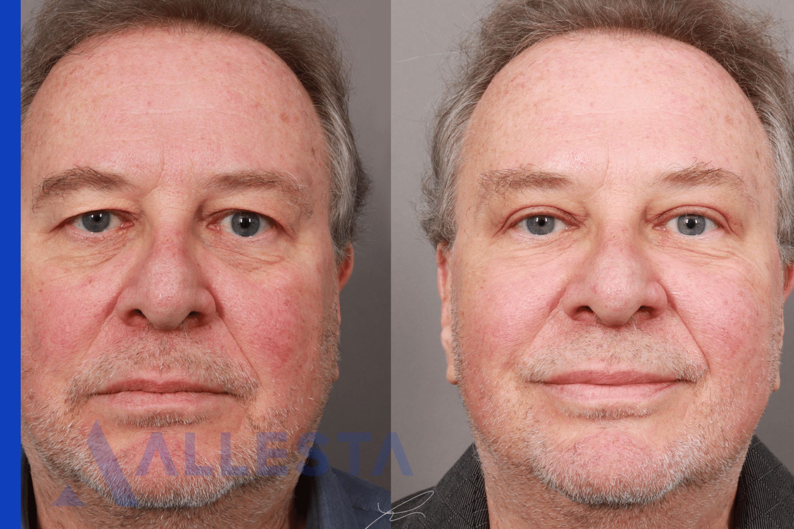 Before and after3-01