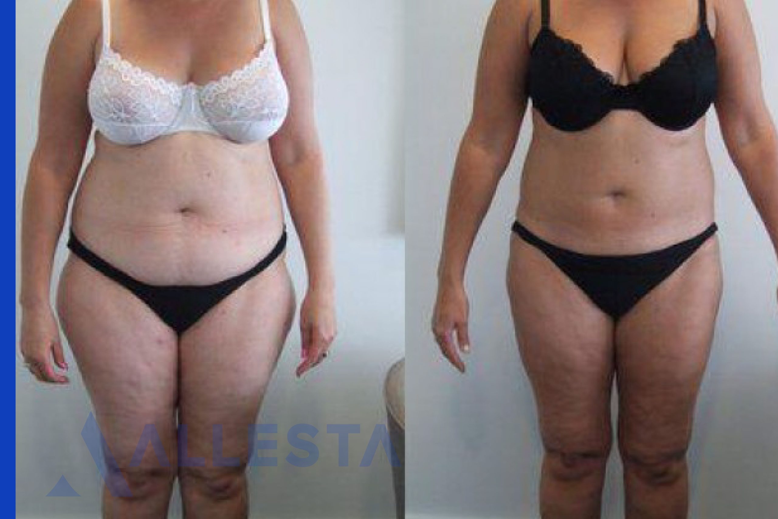 Before and after3-01