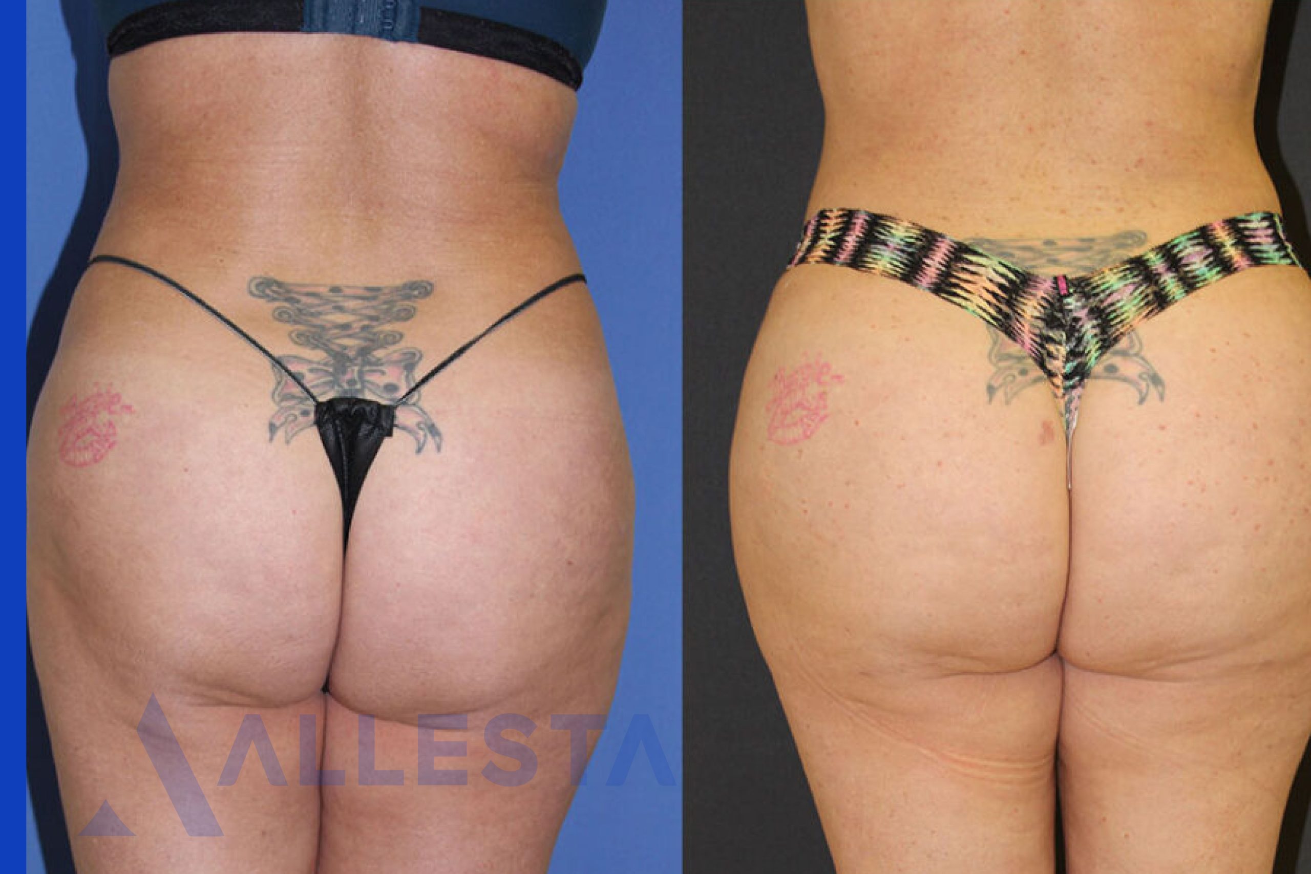 Before and after3-01