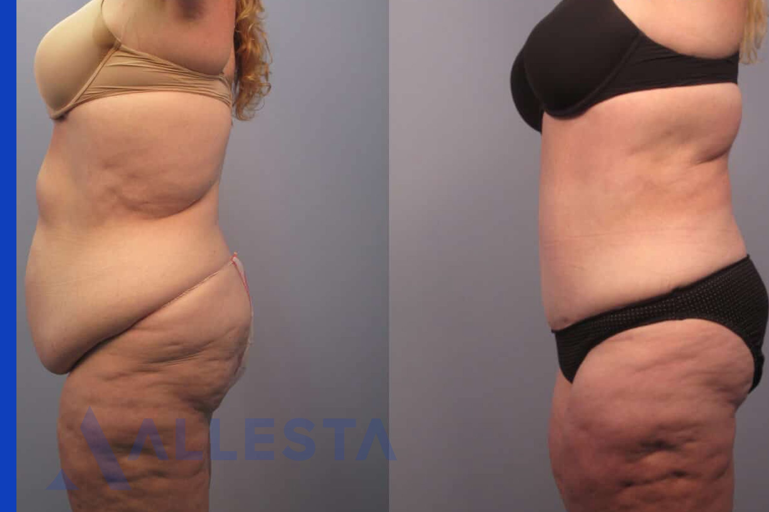 Before and after3-01