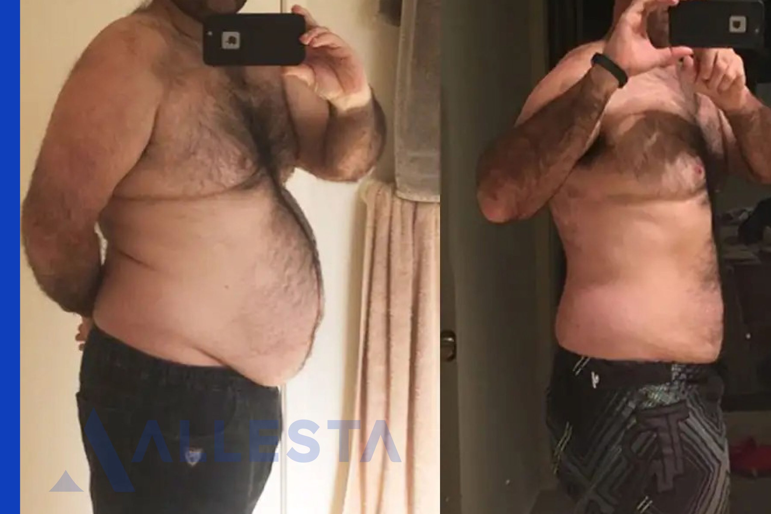 Before and after3-01