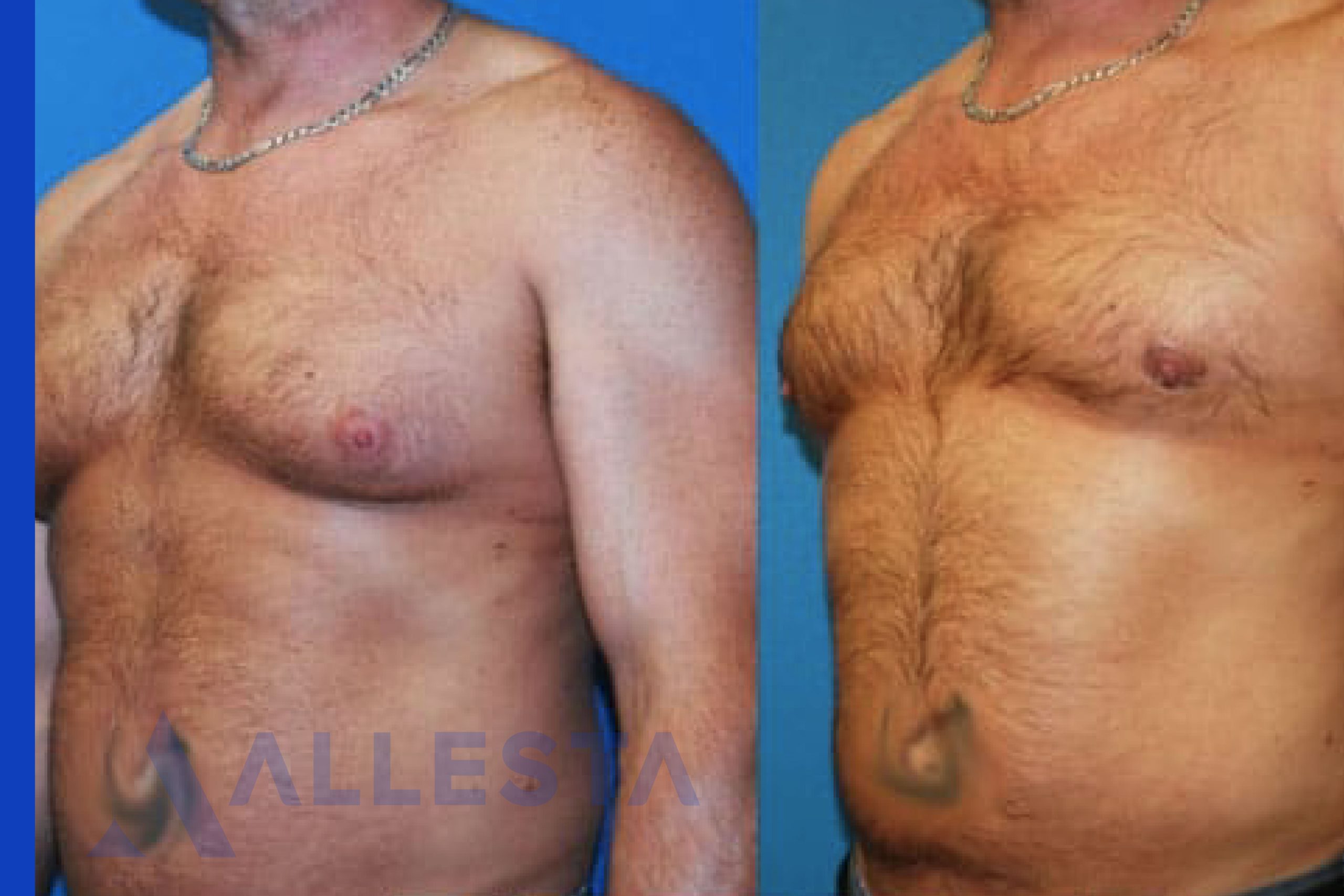 Before and after3-01