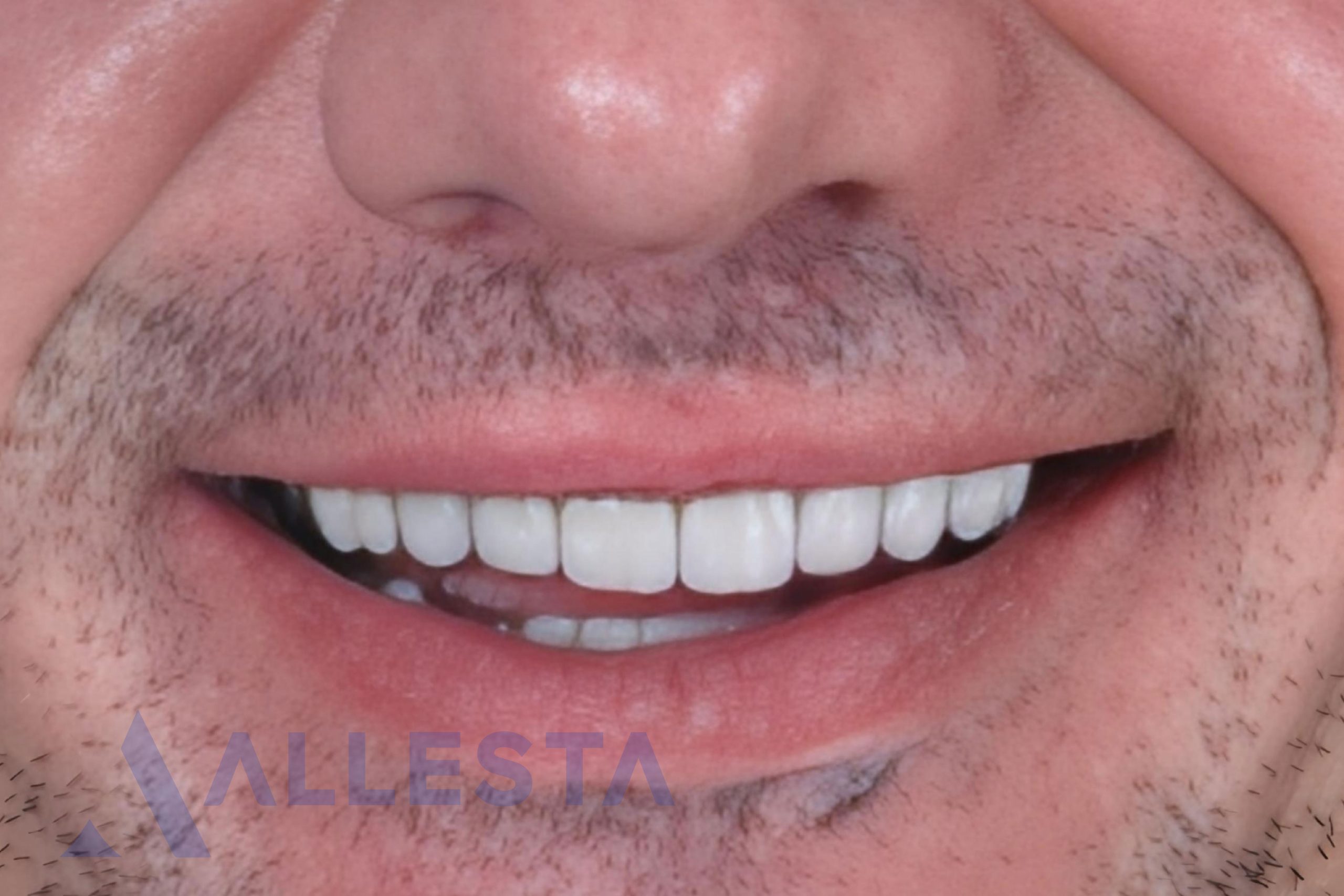 Before and after3-01