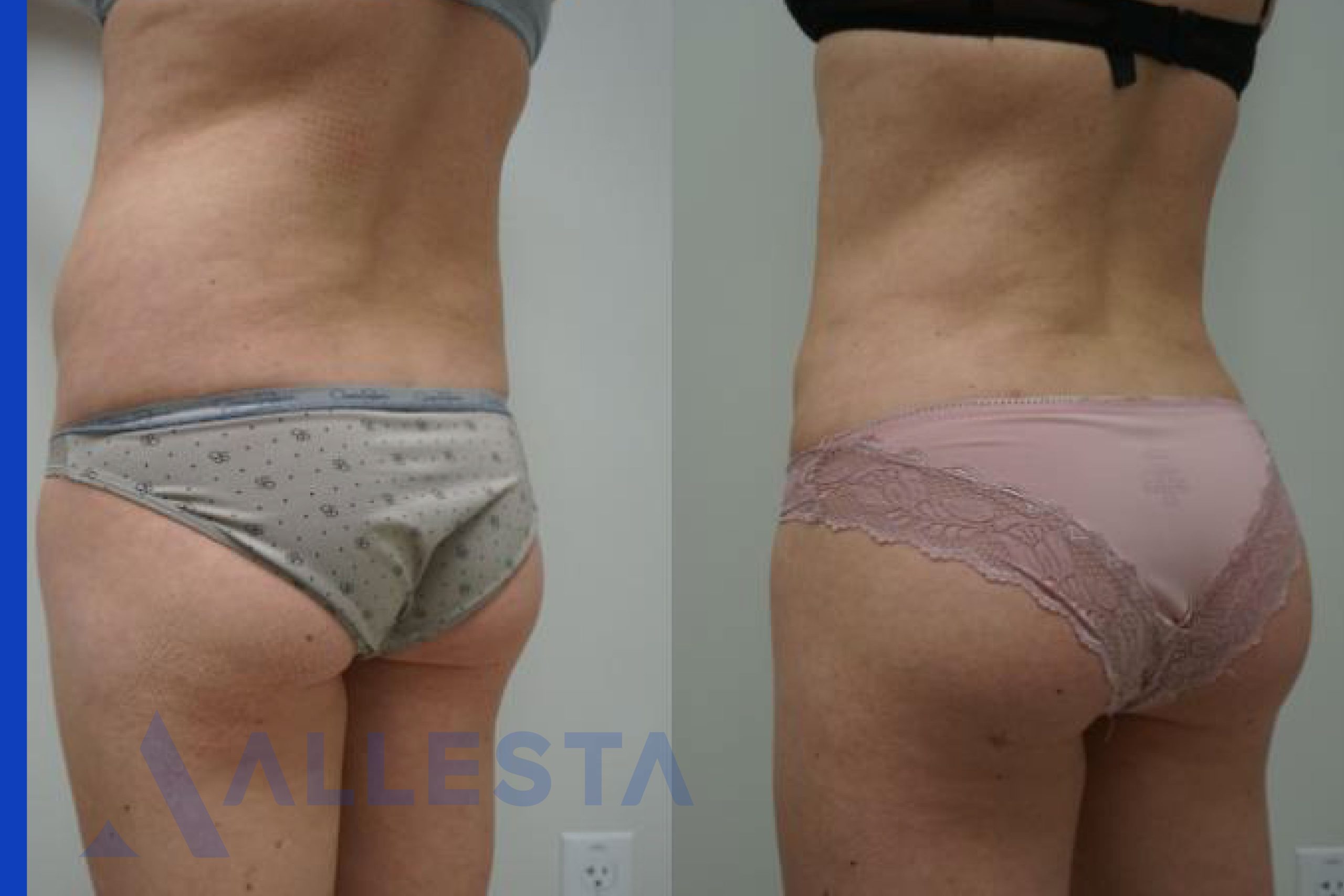 Before and after4-01