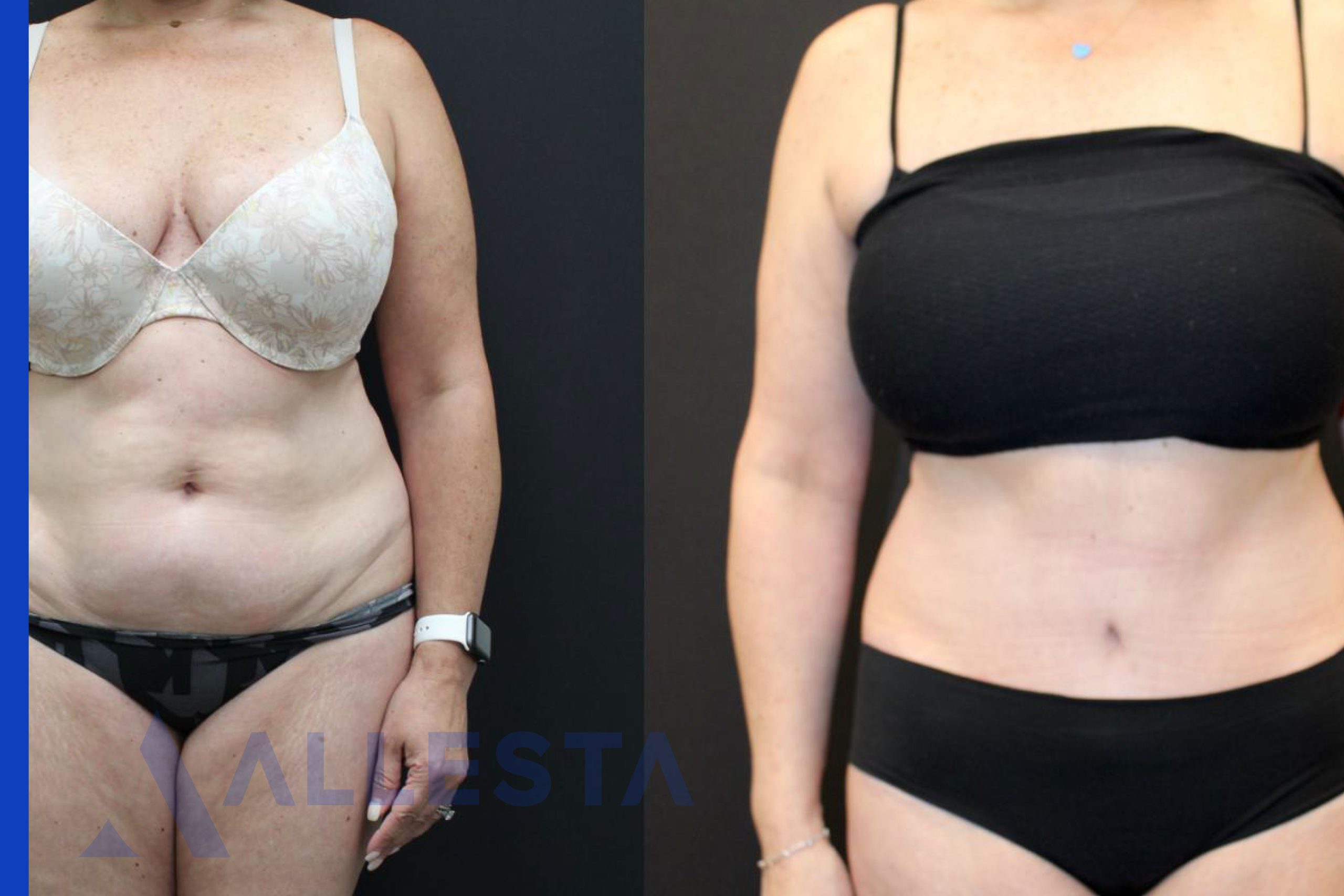 Before and after4-01