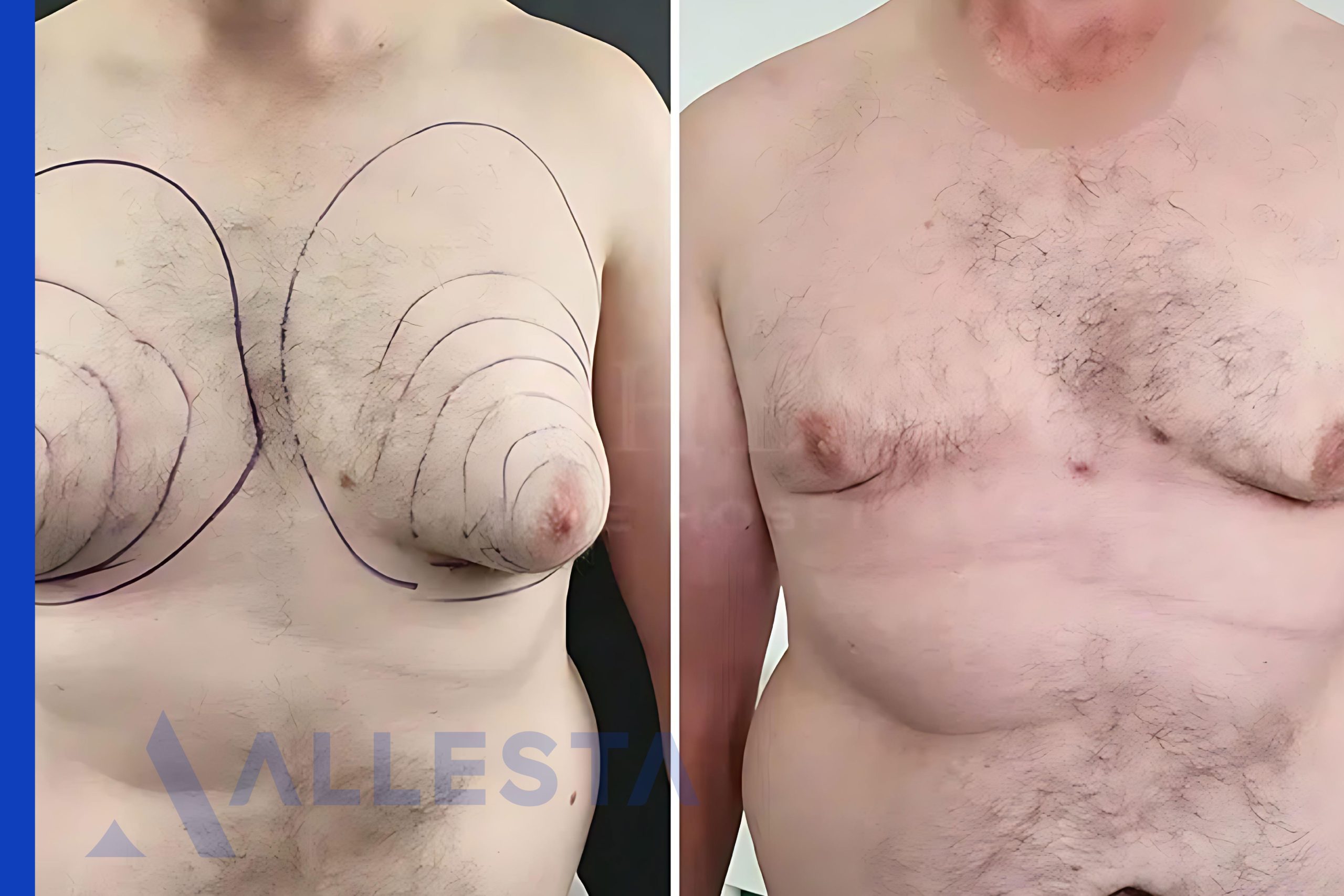 Before and after4-01