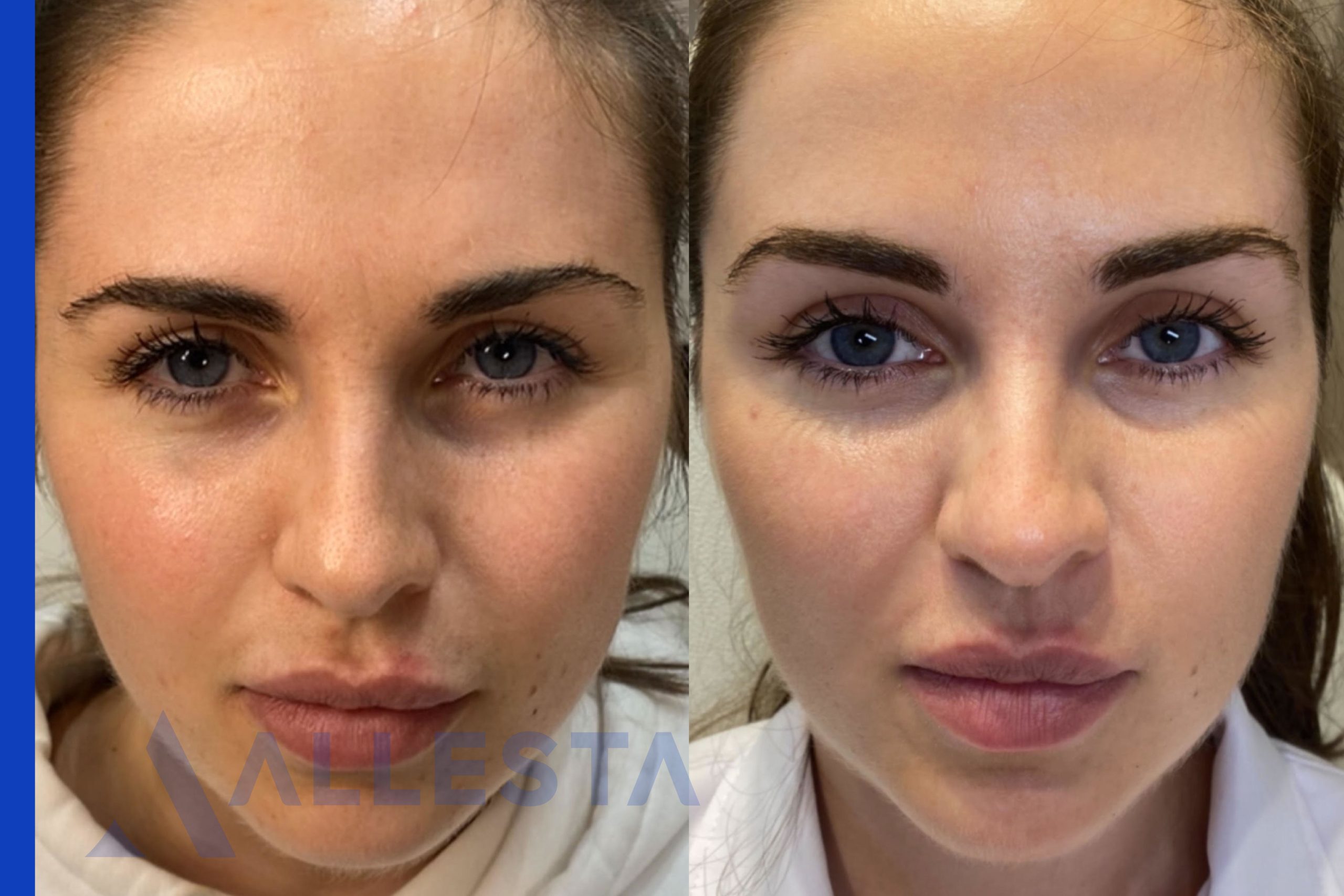 Before and after4-01