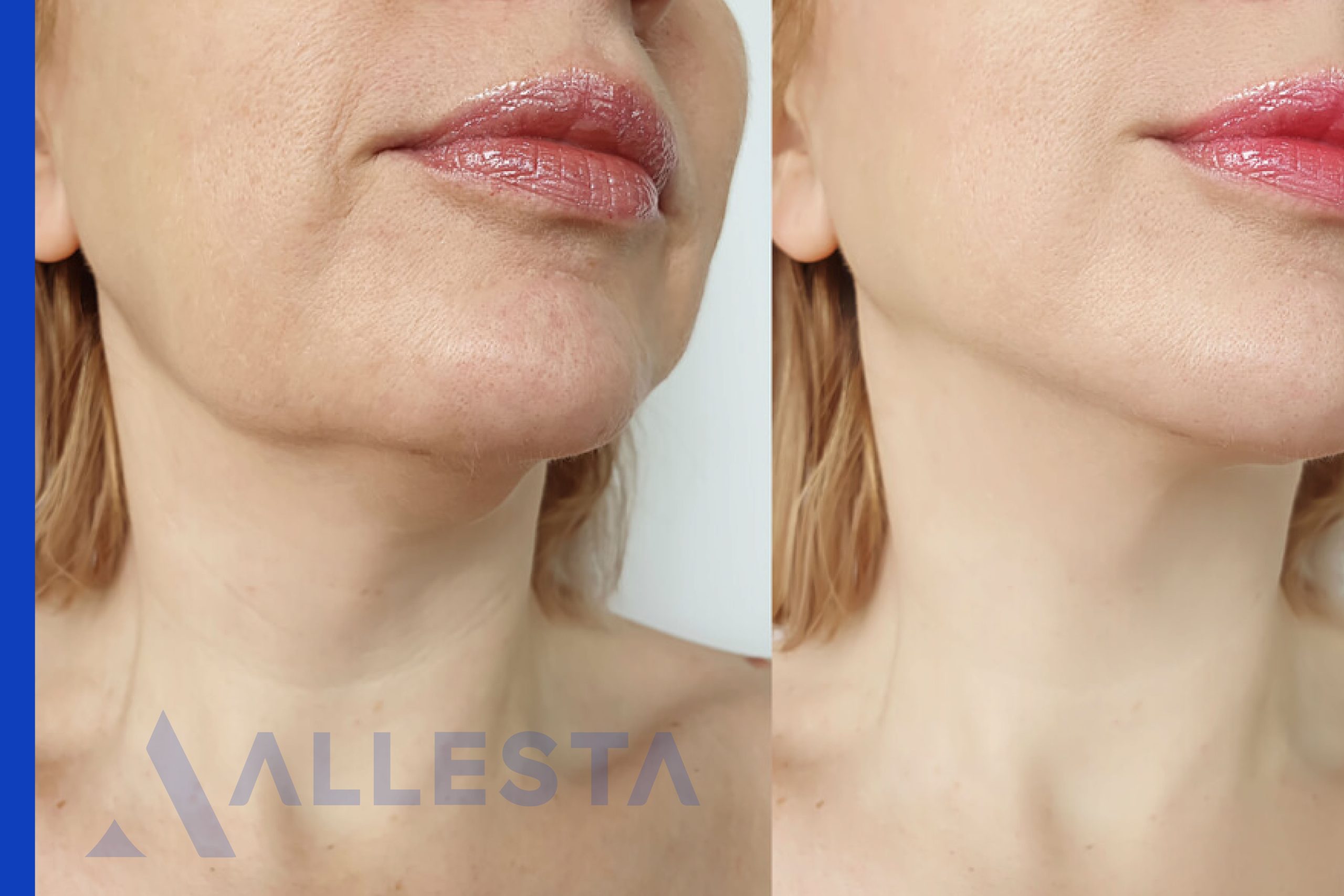 Before and after4-01