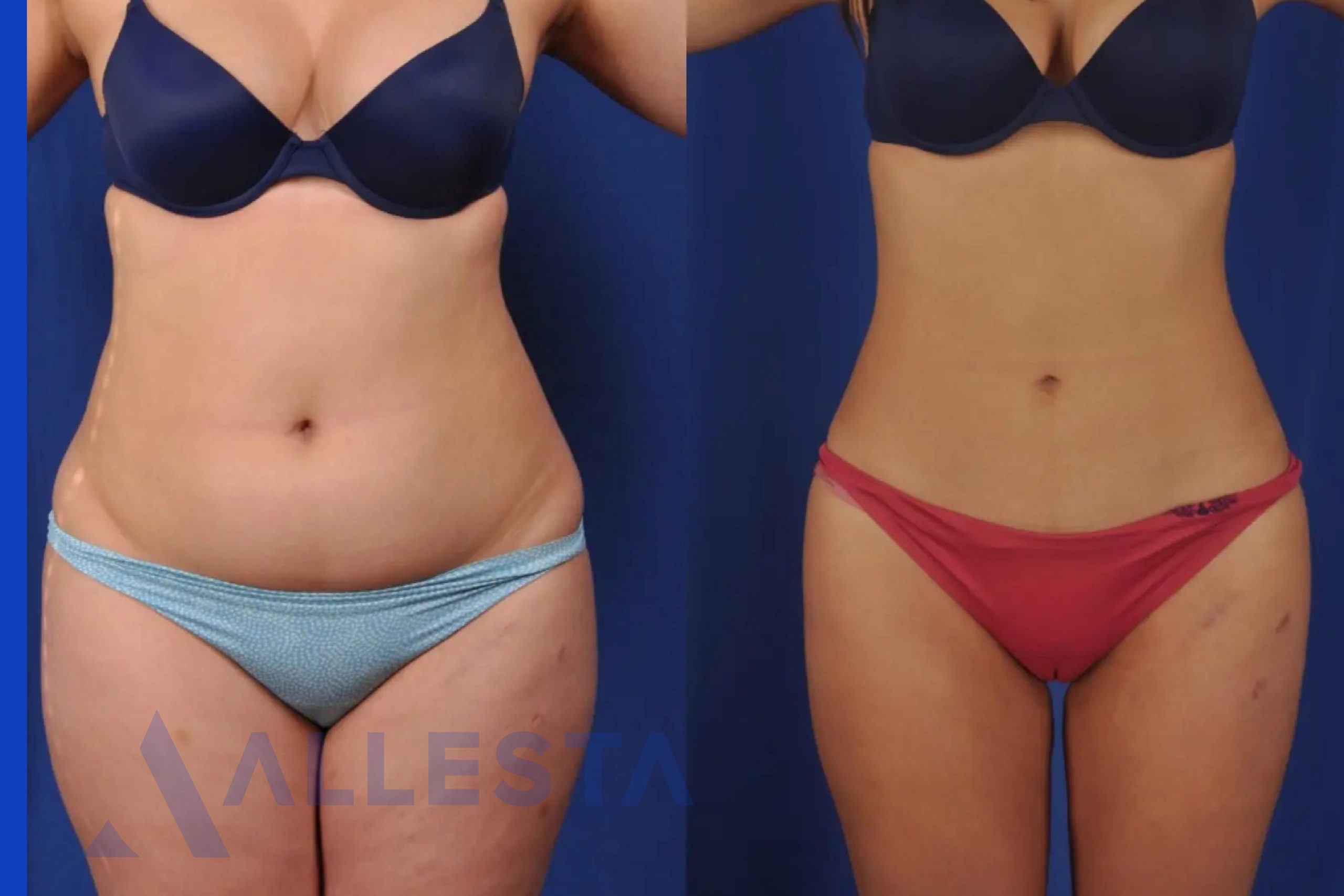 Before and after4-01