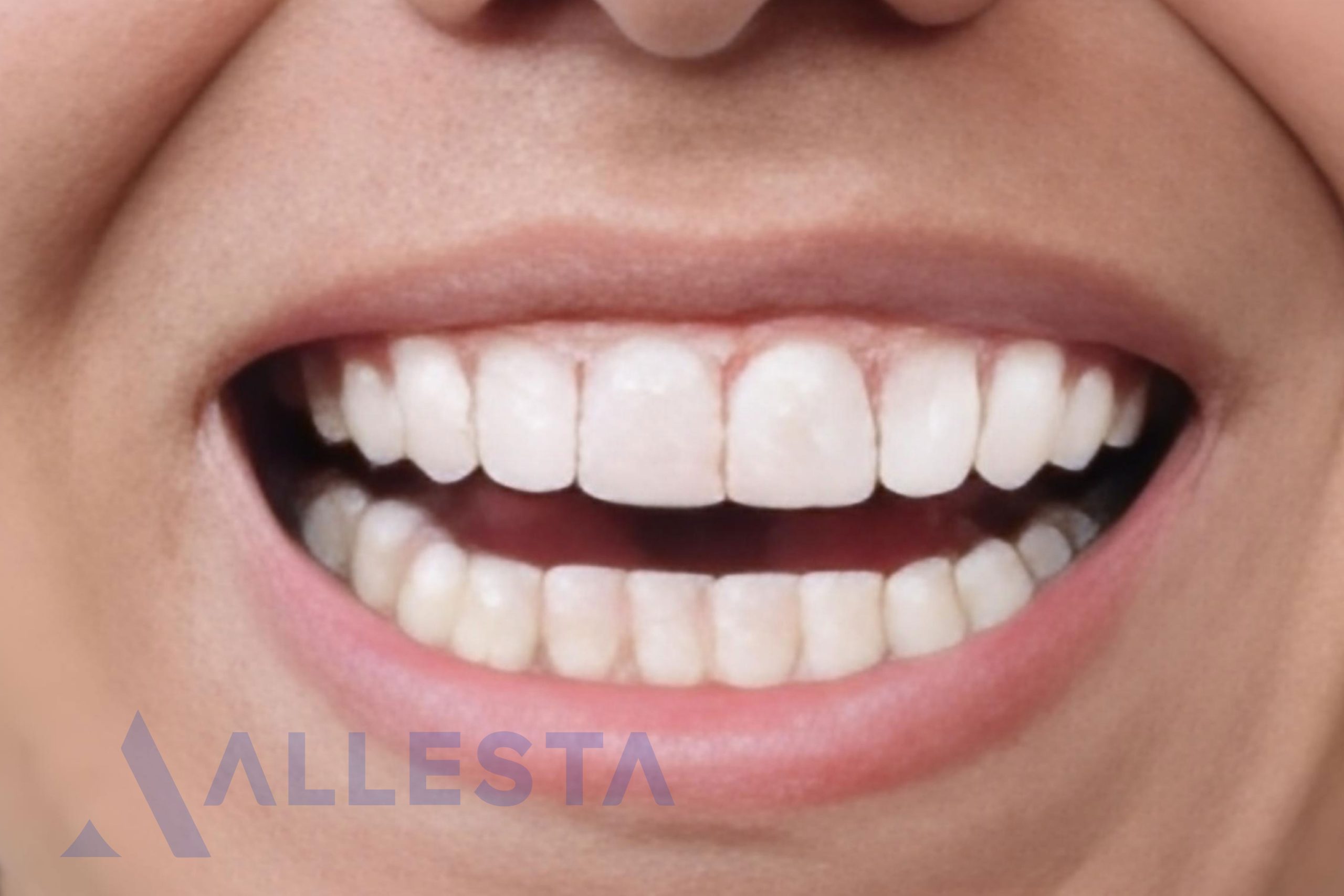 Before and after44-01