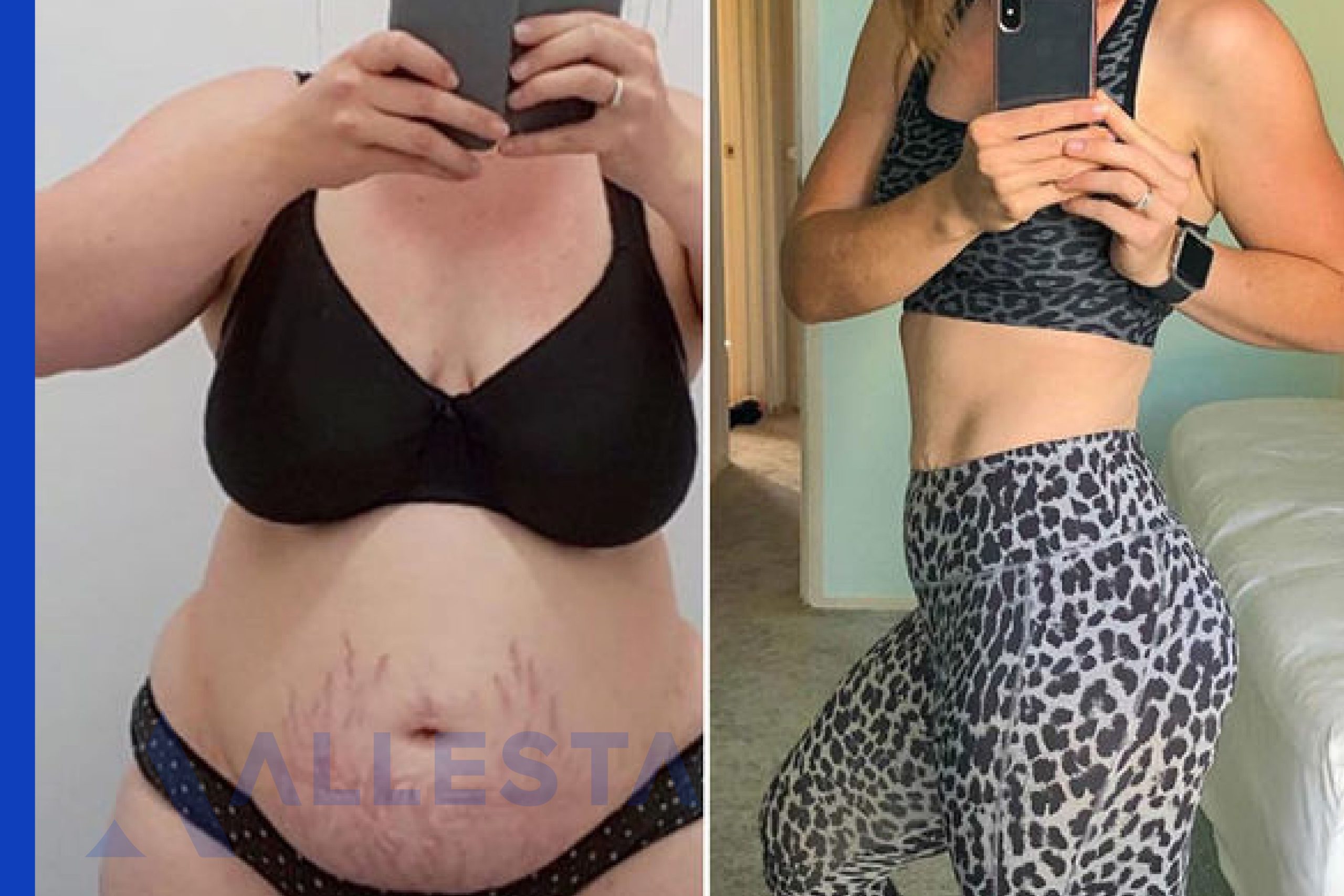 Before and after5-01