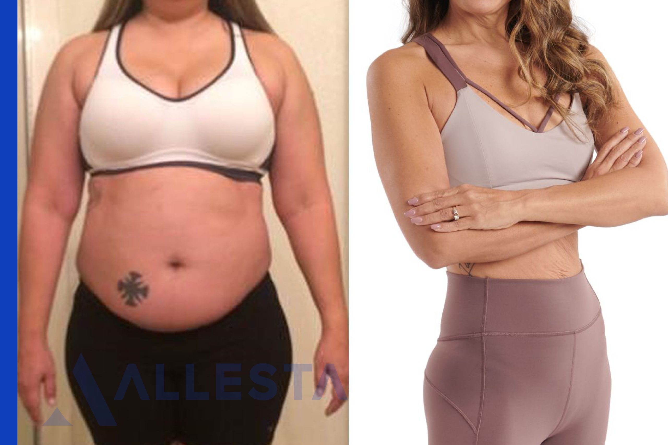 Before and after6-01