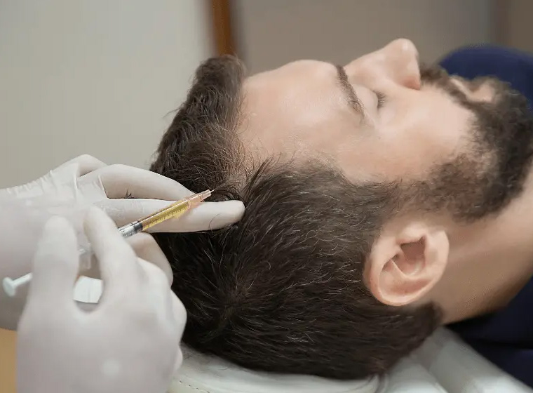 Stem Cell-supported Hair Transplant