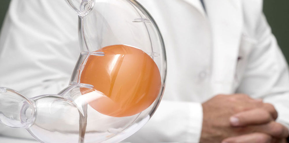 Gastric Balloon Turkey